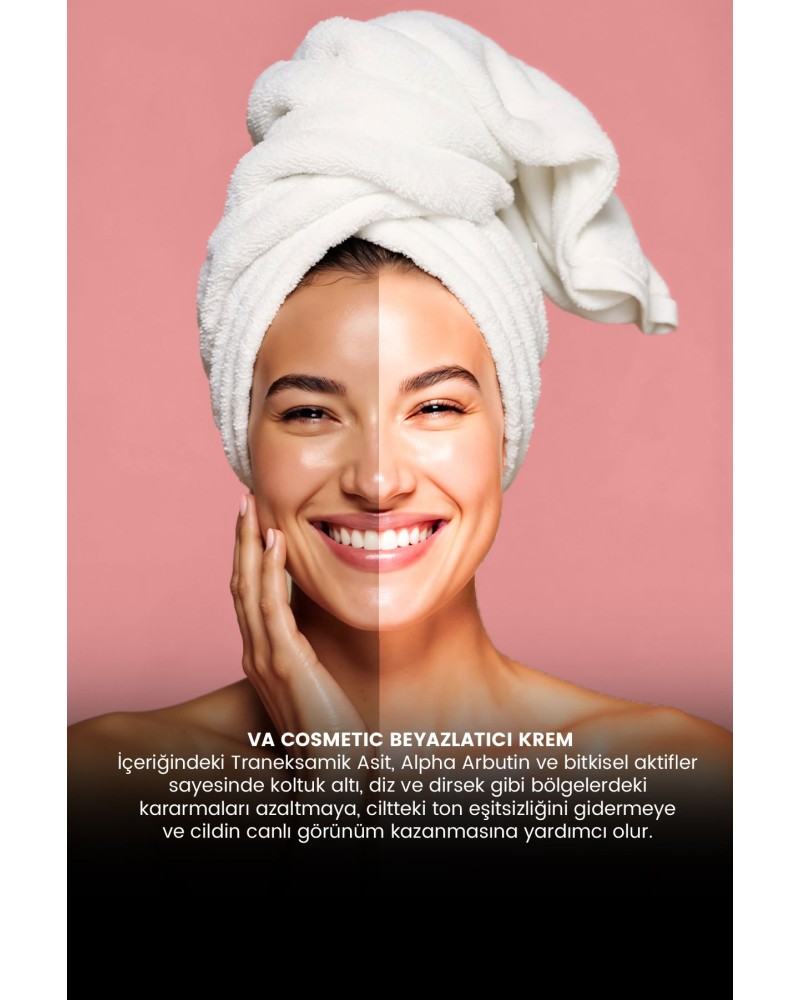 Whıtenıng Cream / Beyazlatıcı Krem 50 Ml